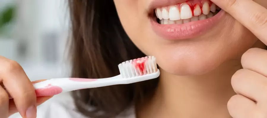 Bleeding Gums While Brushing: Causes and Treatment Options