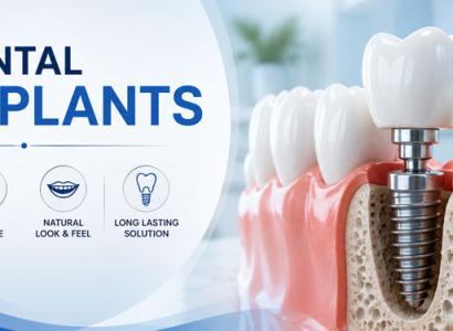 Dental Implants: The Permanent Solution for Missing Teeth
