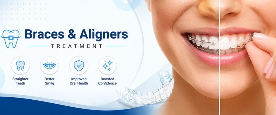 Braces & Aligners Treatment