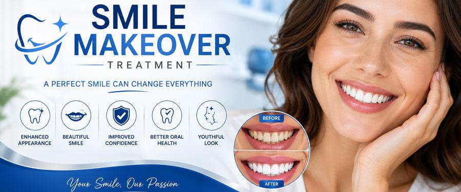 Smile Makeover Treatment