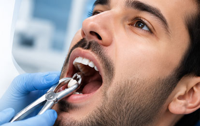 Surgical Tooth Extraction